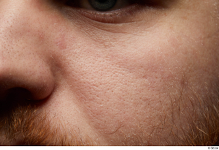 HD Face skin Michael Summers cheek face sin texture skin…